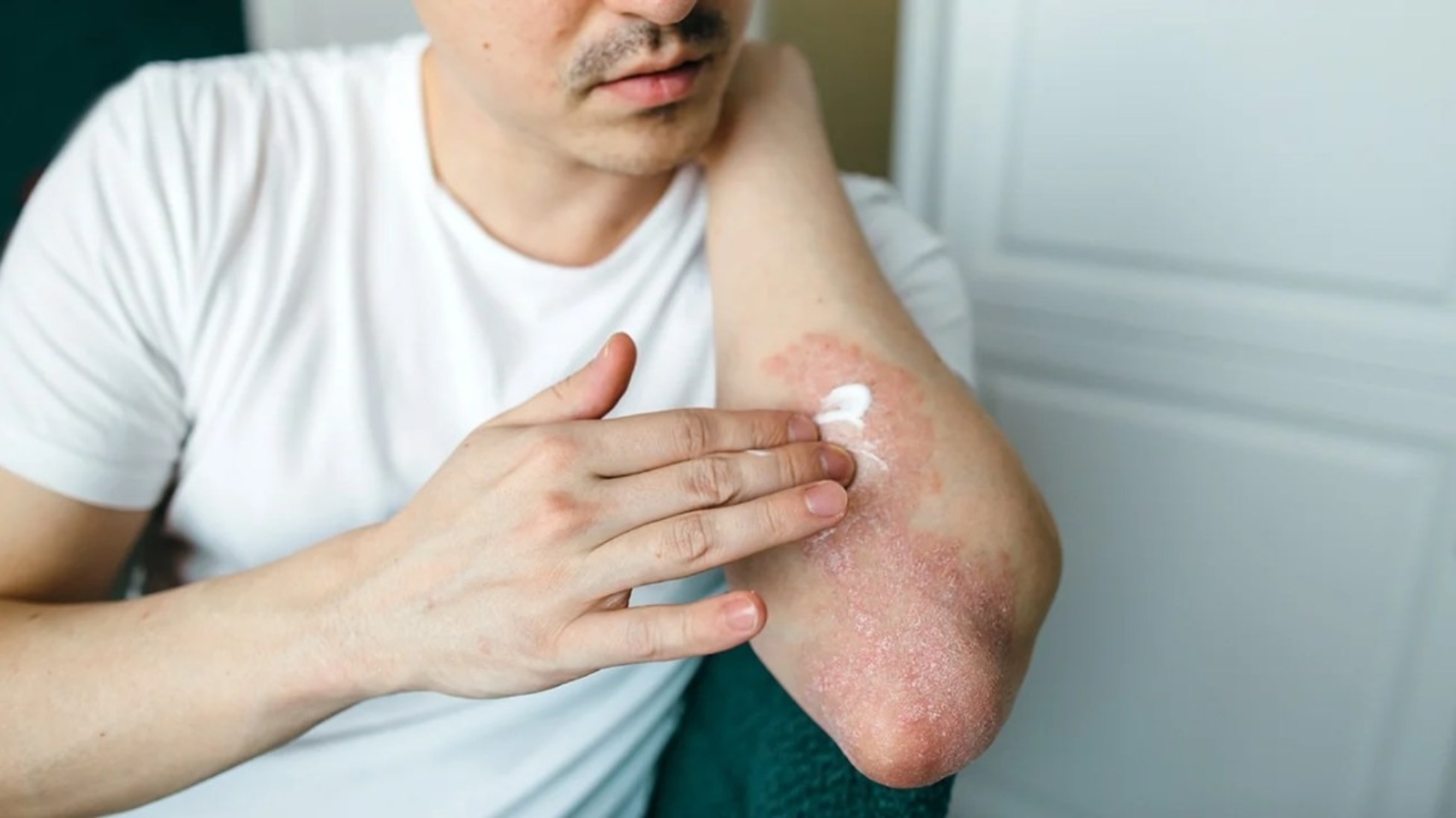 male-applying-skin-cream-1296-72